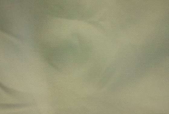 自転車にすってしまったパンツの油シミ|愛知洗い人｜愛知県染み抜きのできるクリーニング店紹介サイト