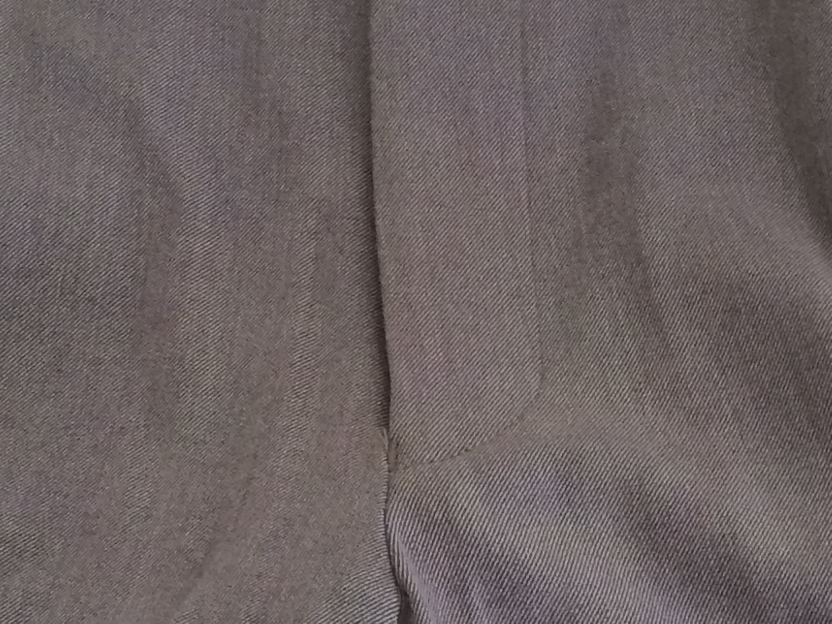 頑固な股の黄ばみがこんなにキレイに！|愛知洗い人｜愛知県染み抜きのできるクリーニング店紹介サイト