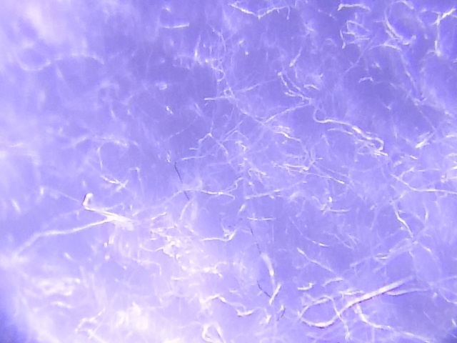 黒カビでしみになっていると思ったんですが|愛知洗い人｜愛知県染み抜きのできるクリーニング店紹介サイト