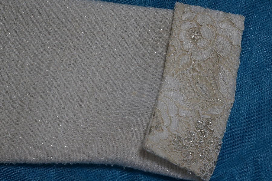 染みがここまで黄変するまでに何年過ぎたのでしょうか。？|愛知洗い人｜愛知県染み抜きのできるクリーニング店紹介サイト