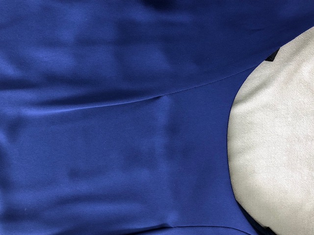 ワンピースについた染み　あま市S様|愛知洗い人｜愛知県染み抜きのできるクリーニング店紹介サイト