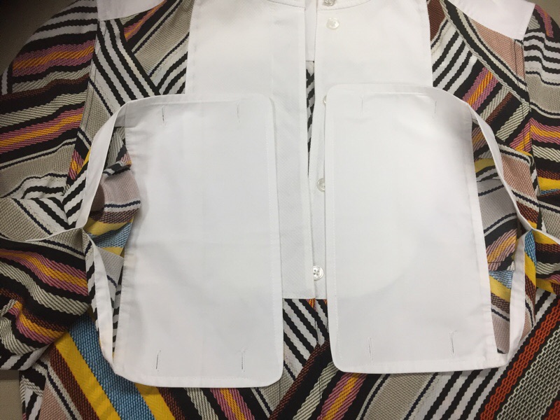 絹/綿ワンピースのシミ取れますか？|愛知洗い人｜愛知県染み抜きのできるクリーニング店紹介サイト