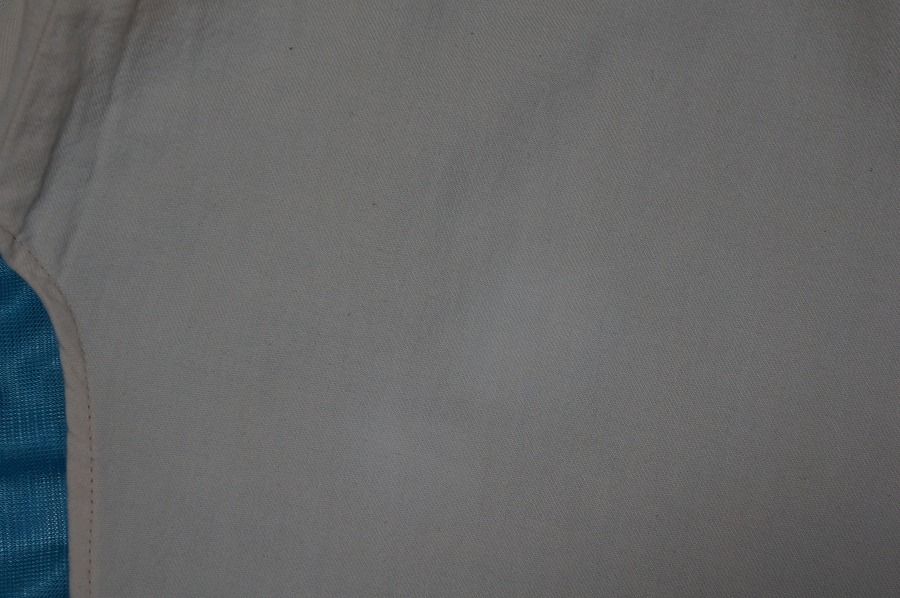 ワンピースの裾に付いた黄ばんだ染み|愛知洗い人｜愛知県染み抜きのできるクリーニング店紹介サイト