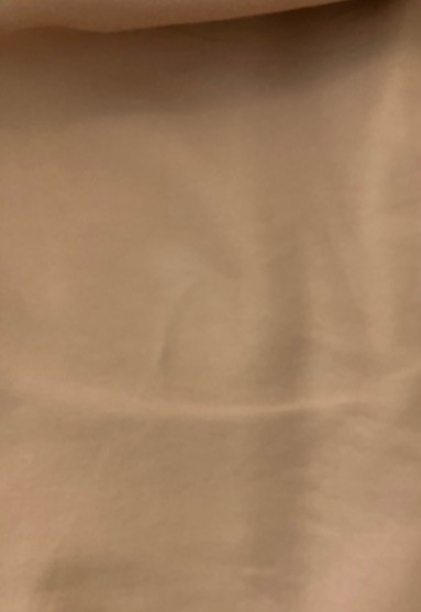 応急処置をしたつもりが|愛知洗い人｜愛知県染み抜きのできるクリーニング店紹介サイト