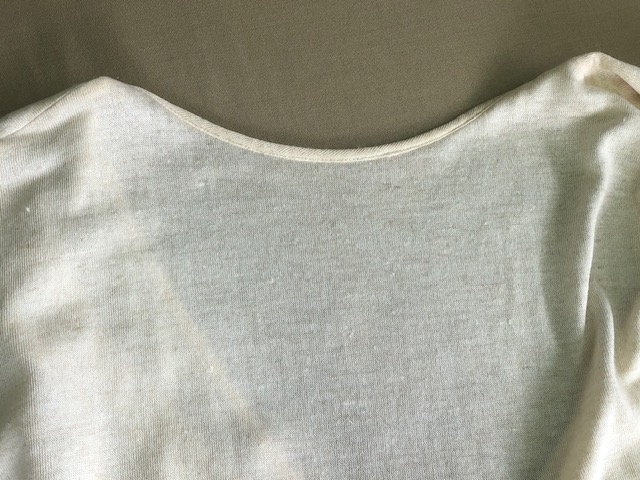 ラグジュアリーブランド麻ワンピースの広範囲黄ばみ　あま市K様|愛知洗い人｜愛知県染み抜きのできるクリーニング店紹介サイト